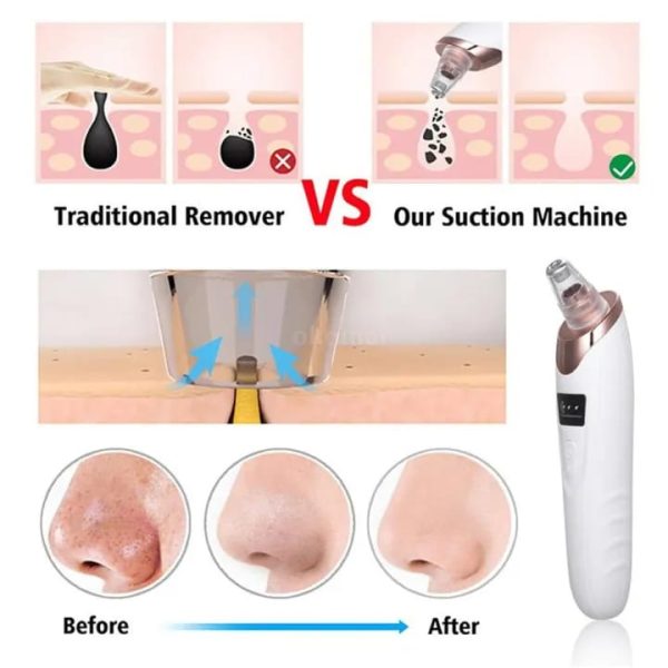 Electric Blackhead Remover & Pore Cleaner – Facial Vacuum Suction for Deep Cleansing & Smooth Skin