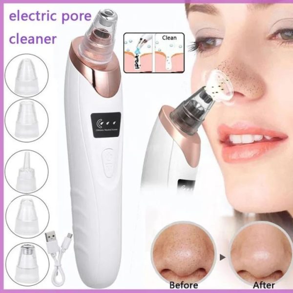 Electric Blackhead Remover & Pore Cleaner – Facial Vacuum Suction for Deep Cleansing & Smooth Skin